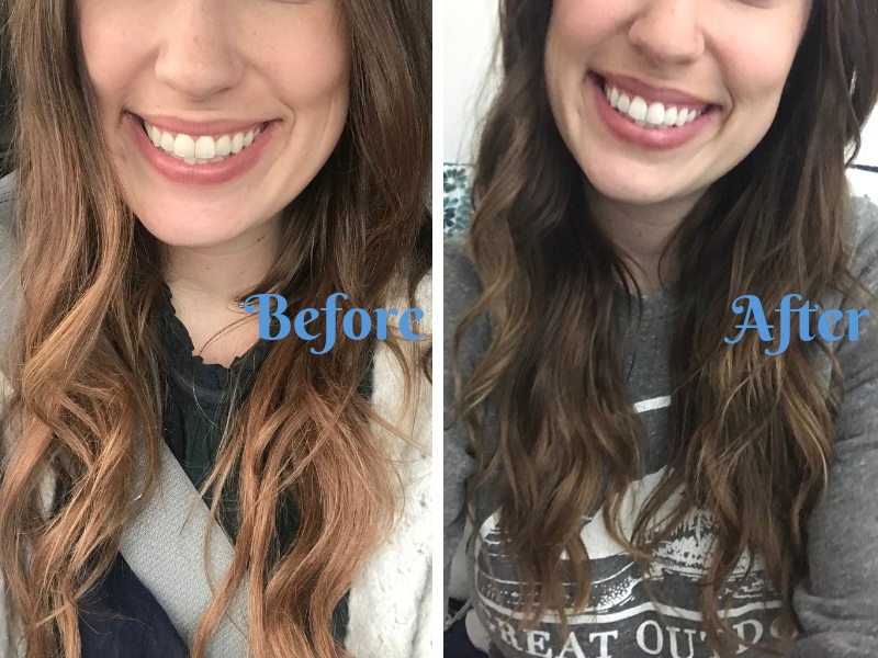Smile | Lifestyle | Beauty | Crest 3D Whitestrips: How to Get Whiter & Brighter Teeth in Only 14 Days featured by top Houston life and style blog Lone Star Looking Glass